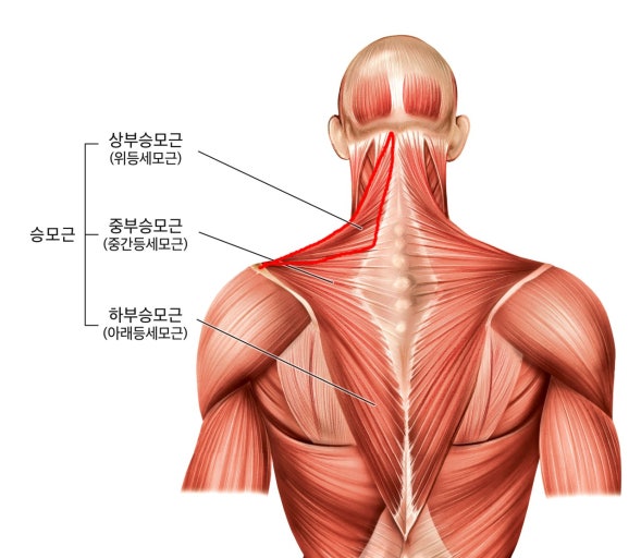 승모근!! 뭉친게아니라 약해서 아플 수 있습니다.